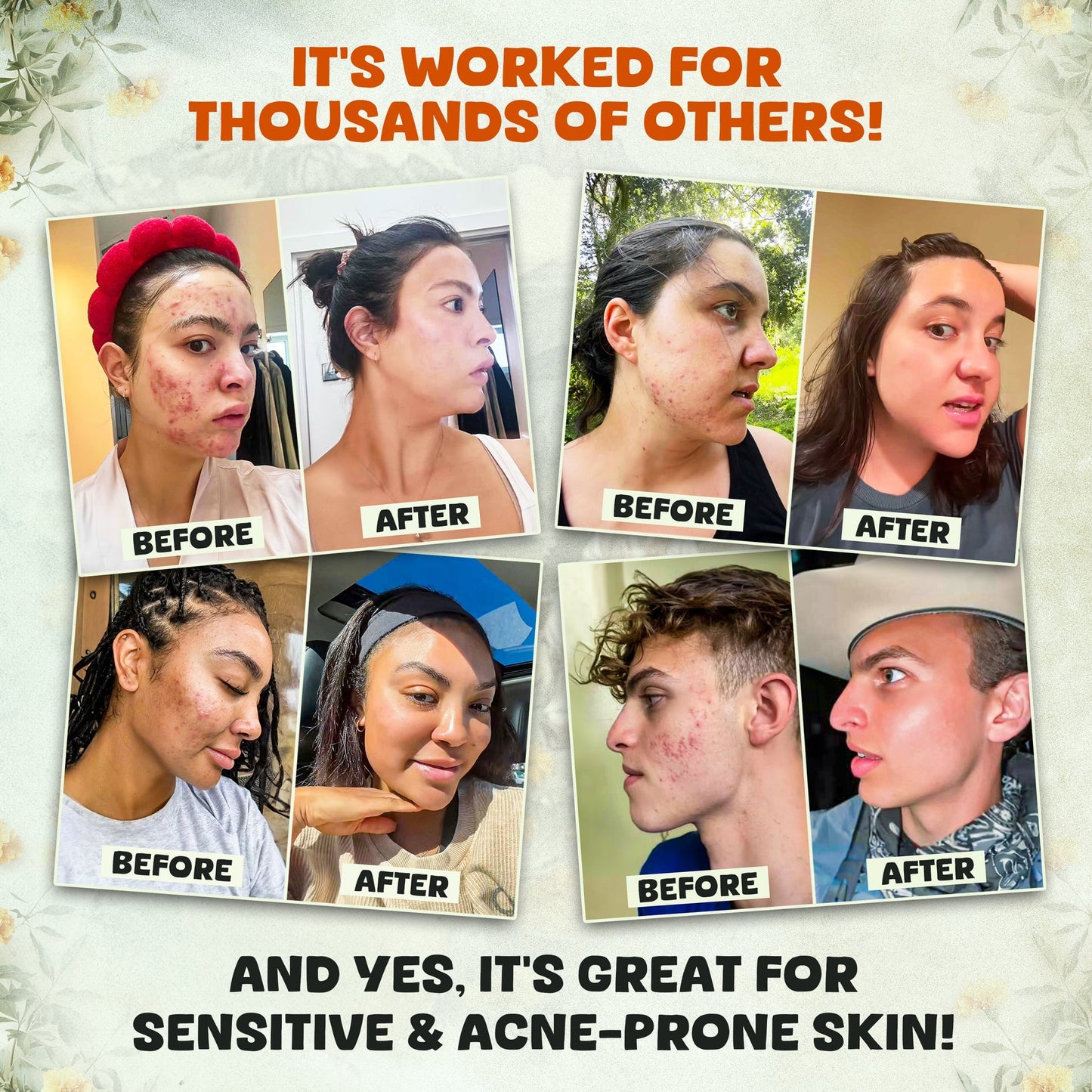 Whipped Beef Tallow & Manuka Honey Balm Face Cream