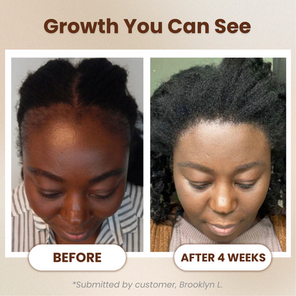 Batana Natural Hair Growth Oil